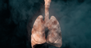 Lung cancer and smoking