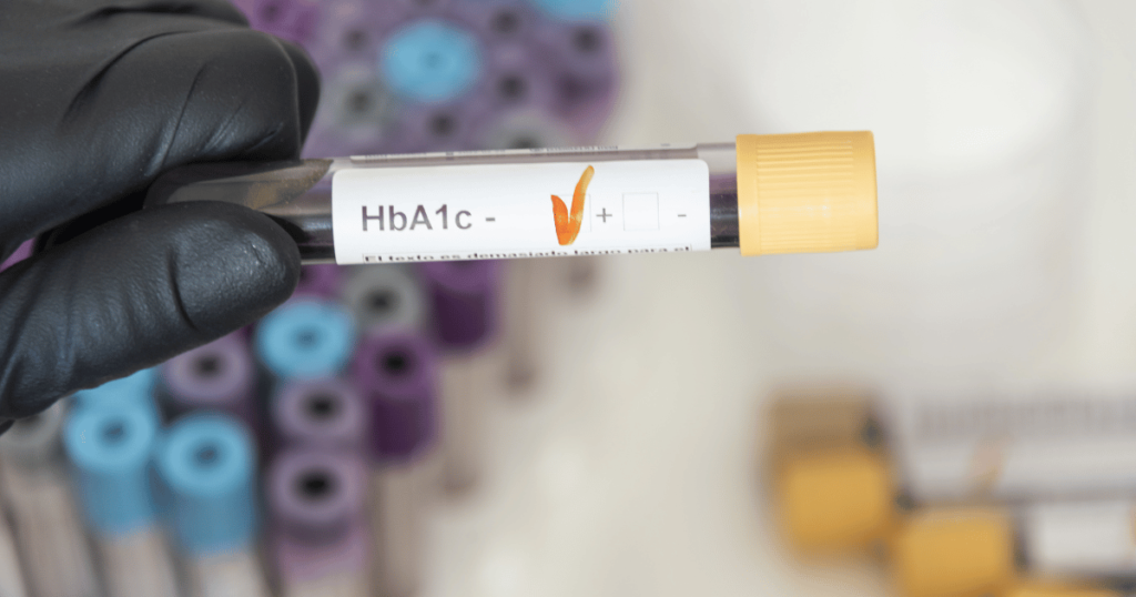 HBA1C Levels