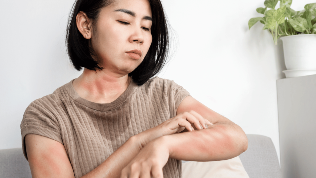 Allergic Reactions and Hives